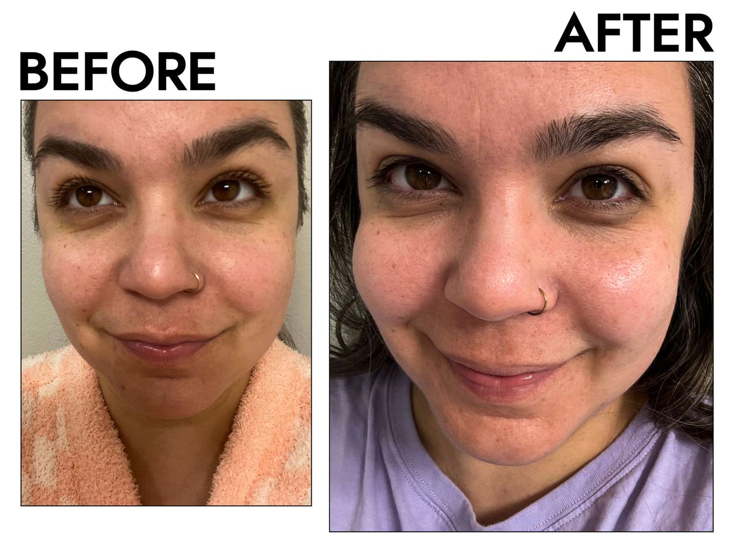 files/byr-face-washes-natural-test-indie-lee-purifying-before-after-tatiana-kennedy-92e7c61bb361453a922f511f2627ccc1.jpg